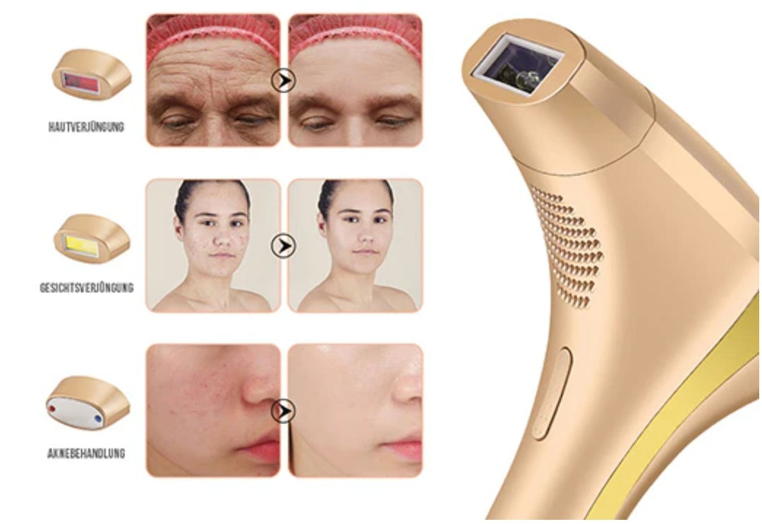 Lovera IPL PureSkin