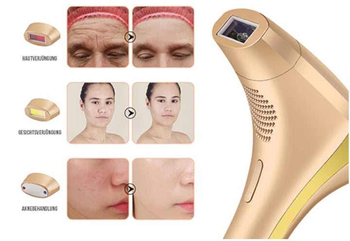 Lovera IPL PureSkin